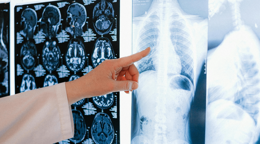 Midlife woman reviewing spine MRI scan results and contemplating chronic back pain causes.